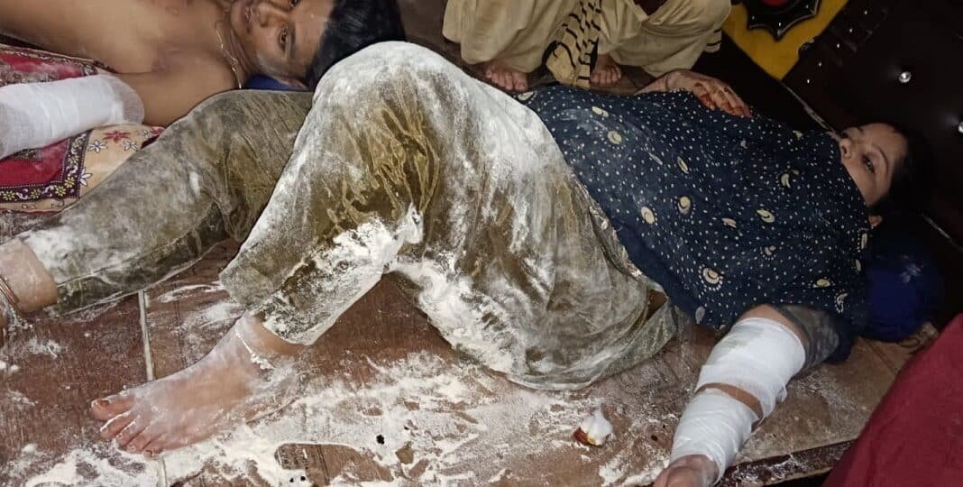 11 हजार वोल्ट के तार से झुलसे 3 लोग